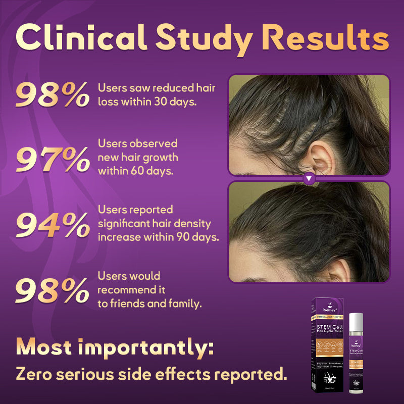 💇‍♀️From Hair Loss to Full Growth✨– How 𝐑𝐨𝐥𝐢𝐦𝐞𝐲® 𝐒𝐓𝐄𝐌 𝐂𝐞𝐥𝐥 𝐇𝐚𝐢𝐫 𝐂𝐲𝐜𝐥𝐞 𝐑𝐨𝐥𝐥𝐞𝐫 Reverses Follicle Dormancy |👨‍⚕️Developed by Trichologists |🦘TGA Registered