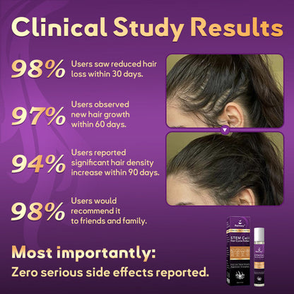 💇‍♀️From Hair Loss to Full Growth✨– How 𝐑𝐨𝐥𝐢𝐦𝐞𝐲® 𝐒𝐓𝐄𝐌 𝐂𝐞𝐥𝐥 𝐇𝐚𝐢𝐫 𝐂𝐲𝐜𝐥𝐞 𝐑𝐨𝐥𝐥𝐞𝐫 Reverses Follicle Dormancy |👨‍⚕️Developed by Trichologists |🦘TGA Registered