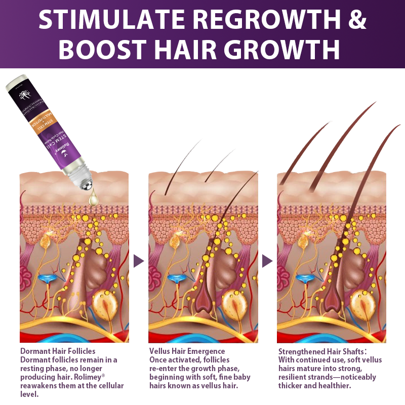💇‍♀️From Hair Loss to Full Growth✨– How 𝐑𝐨𝐥𝐢𝐦𝐞𝐲® 𝐒𝐓𝐄𝐌 𝐂𝐞𝐥𝐥 𝐇𝐚𝐢𝐫 𝐂𝐲𝐜𝐥𝐞 𝐑𝐨𝐥𝐥𝐞𝐫 Reverses Follicle Dormancy |👨‍⚕️Developed by Trichologists |🦘TGA Registered