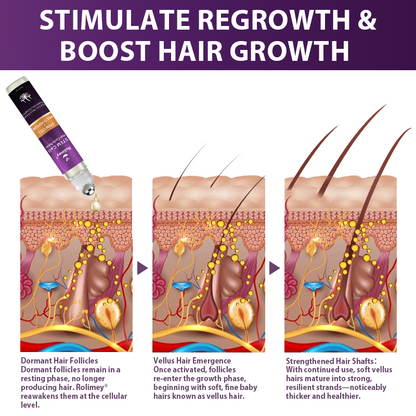 💇‍♀️From Hair Loss to Full Growth✨– How 𝐑𝐨𝐥𝐢𝐦𝐞𝐲® 𝐒𝐓𝐄𝐌 𝐂𝐞𝐥𝐥 𝐇𝐚𝐢𝐫 𝐂𝐲𝐜𝐥𝐞 𝐑𝐨𝐥𝐥𝐞𝐫 Reverses Follicle Dormancy |👨‍⚕️Developed by Trichologists |🦘TGA Registered