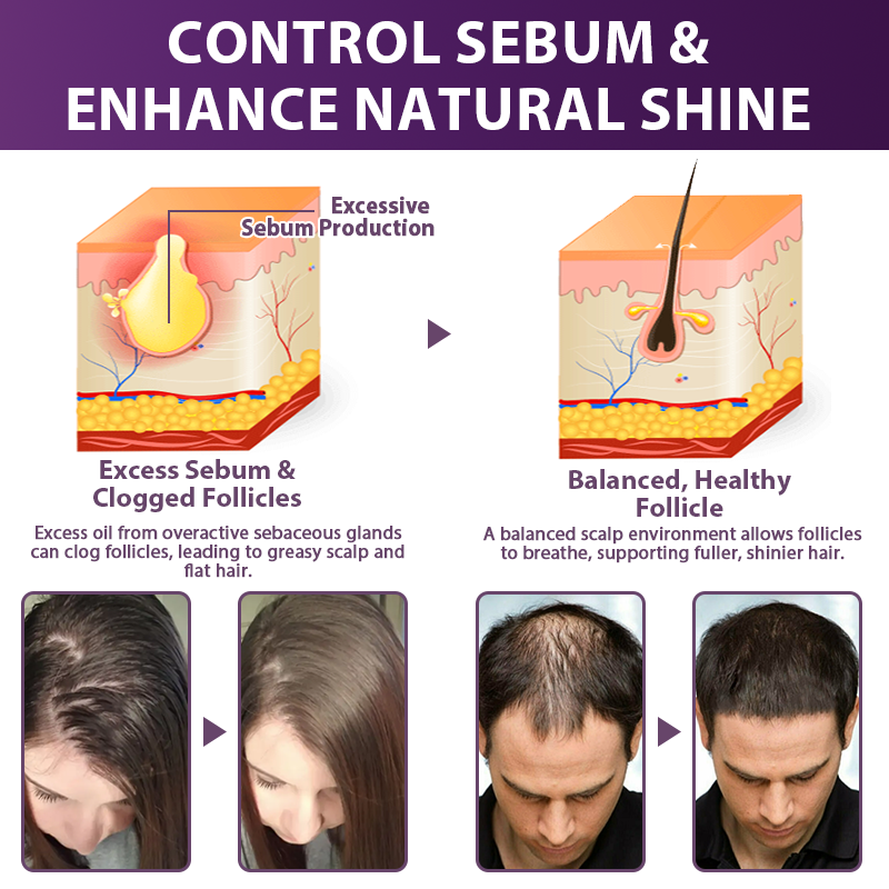 💇‍♀️From Hair Loss to Full Growth✨– How 𝐑𝐨𝐥𝐢𝐦𝐞𝐲® 𝐒𝐓𝐄𝐌 𝐂𝐞𝐥𝐥 𝐇𝐚𝐢𝐫 𝐂𝐲𝐜𝐥𝐞 𝐑𝐨𝐥𝐥𝐞𝐫 Reverses Follicle Dormancy |👨‍⚕️Developed by Trichologists |🦘TGA Registered