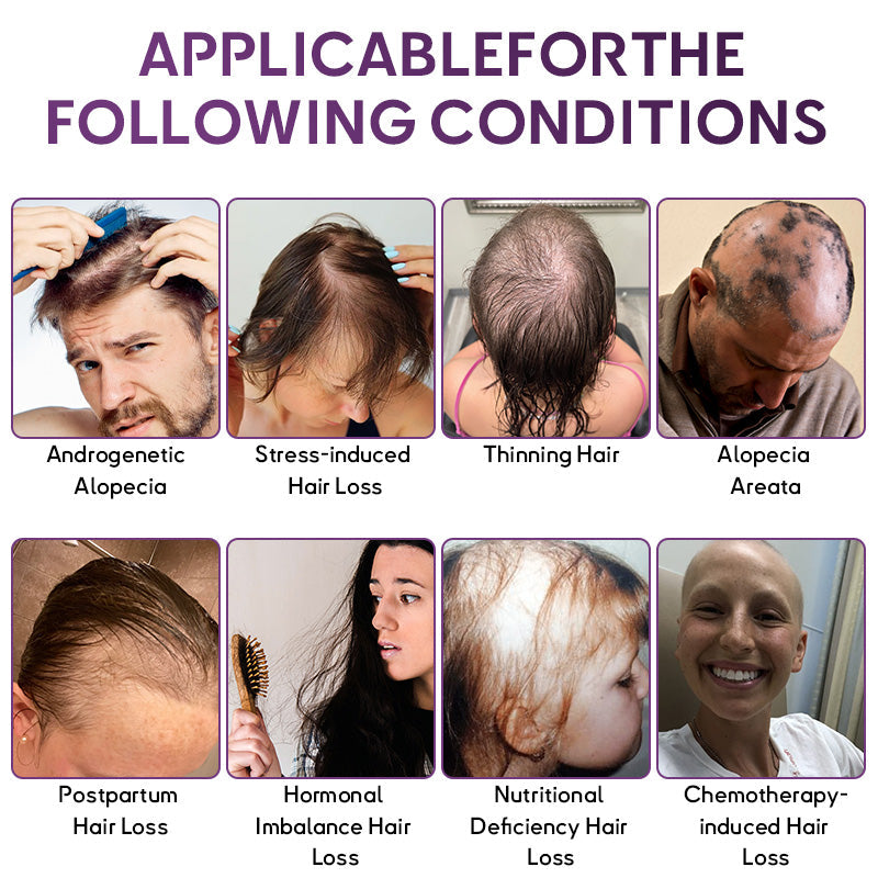 💇‍♀️From Hair Loss to Full Growth✨– How 𝐑𝐨𝐥𝐢𝐦𝐞𝐲® 𝐒𝐓𝐄𝐌 𝐂𝐞𝐥𝐥 𝐇𝐚𝐢𝐫 𝐂𝐲𝐜𝐥𝐞 𝐑𝐨𝐥𝐥𝐞𝐫 Reverses Follicle Dormancy |👨‍⚕️Developed by Trichologists |🦘TGA Registered