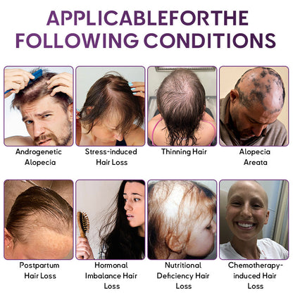 💇‍♀️From Hair Loss to Full Growth✨– How 𝐑𝐨𝐥𝐢𝐦𝐞𝐲® 𝐒𝐓𝐄𝐌 𝐂𝐞𝐥𝐥 𝐇𝐚𝐢𝐫 𝐂𝐲𝐜𝐥𝐞 𝐑𝐨𝐥𝐥𝐞𝐫 Reverses Follicle Dormancy |👨‍⚕️Developed by Trichologists |🦘TGA Registered